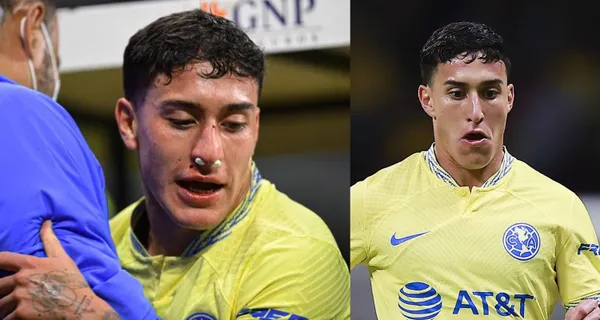 Alejandro Zendejas así quedó tras el golpe que le dieron y esto dijo sobre la agresión por la que protesta el América.