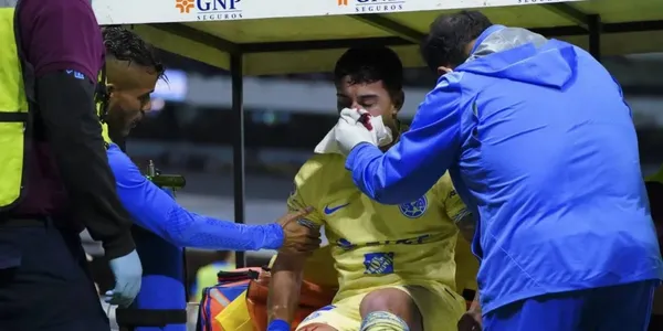 Alejandro Zendejas con la nariz rota tras el codazo de Jesús Gallardo en el América vs Rayados.