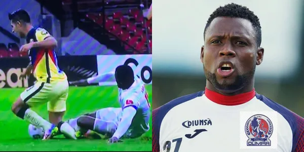 Club América clasificó a la siguiente ronda de la Concachampions pero perdió a Jesús López luego de una entrada fuerte de Yustin Arboleda. Ahora las Águilas pedirán una sanción para el jugador de Olimpia