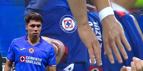 El jugador de Cruz Azul sufrió un choque con un centrocampista del Puebla