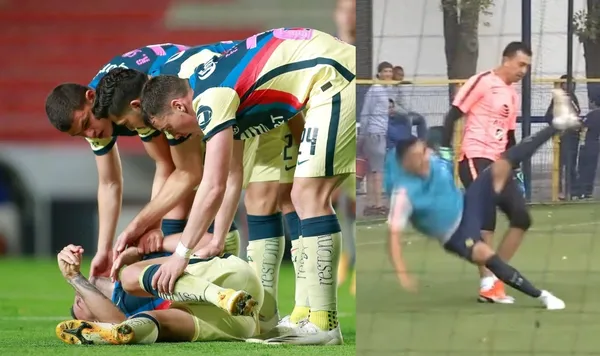 Increíble pero esta vez se revela que uno de los jugadores del América provocó la lesión de gravedad de una de sus figuras jóvenes.