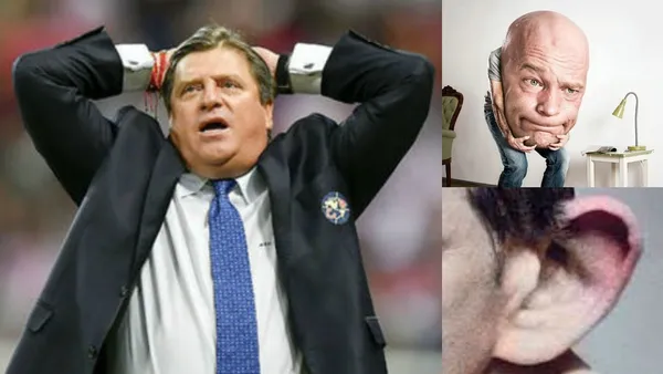 No le dicen solamente piojo. De los dos mejores apodos que tiene Miguel Herrera, hay uno que le hace perder la cabeza.