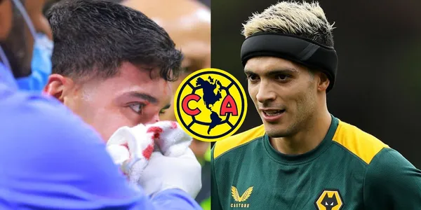 No parecía tan grave como se veía y ahora Alejandro Zendejas debería usar una protección como Raúl Jiménez