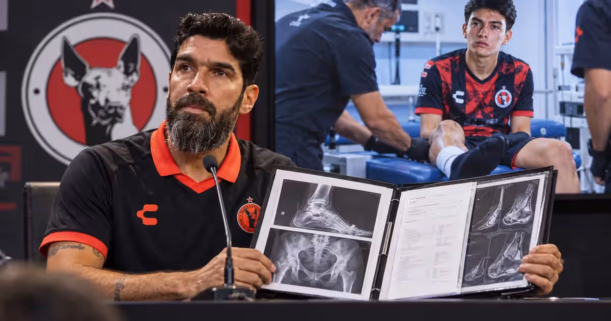 Abreu y la lesión de Gilberto Mora