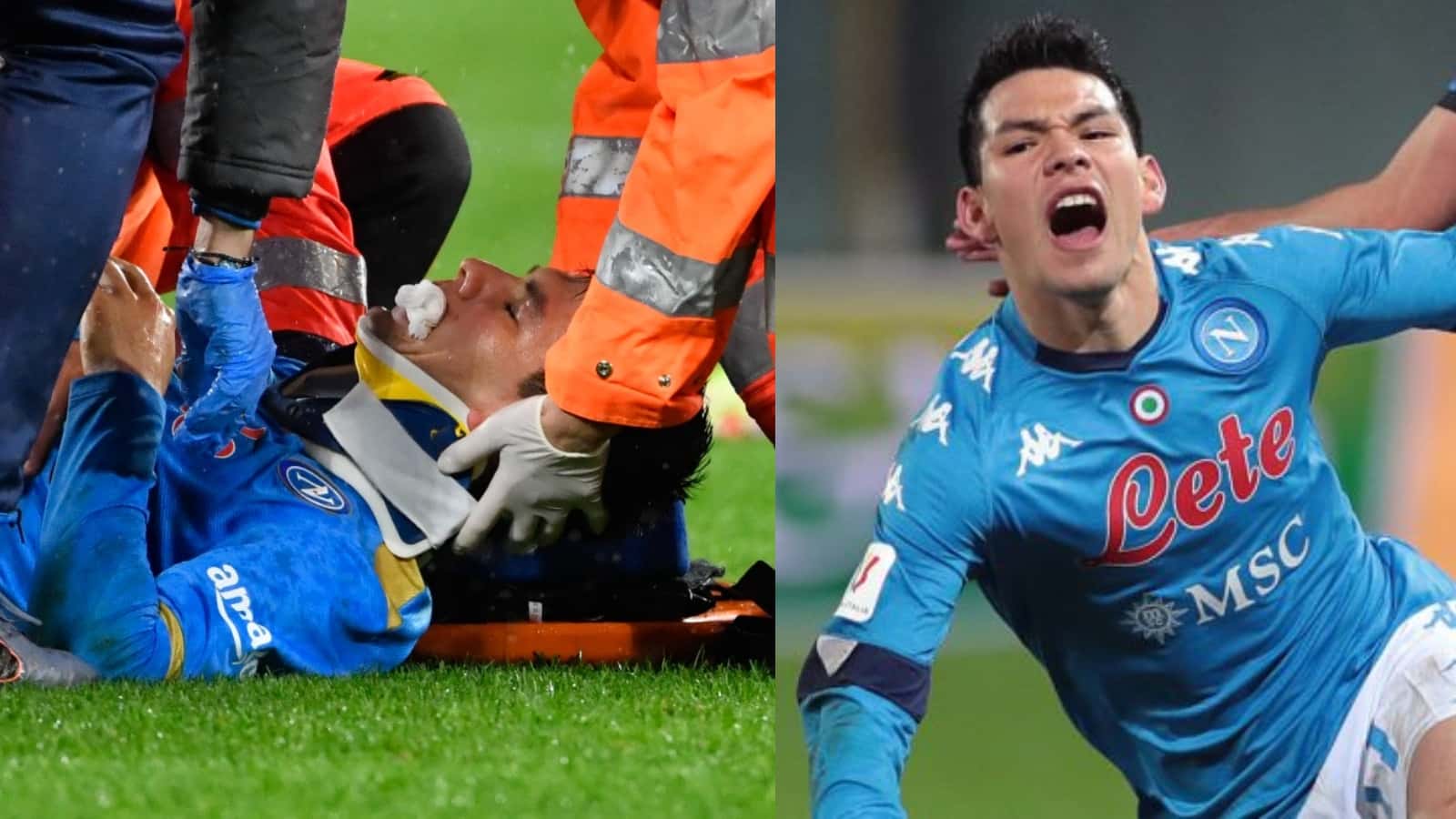 Hirving Lozano sufrió una grave lesión en Italia, donde perdió un diente y sufrió una raspadura, el Chucky colgó una imagen luego de la intervención estética