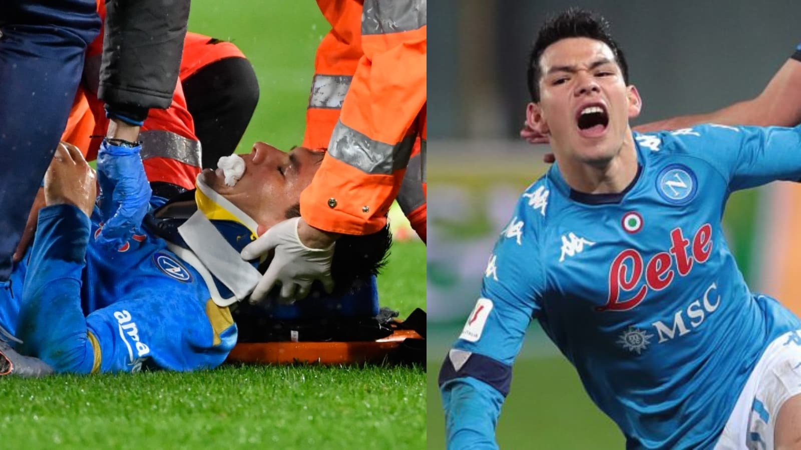 Hirving Lozano sufrió una grave lesión en Italia, donde perdió un diente y sufrió una raspadura, el Chucky colgó una imagen luego de la intervención estética