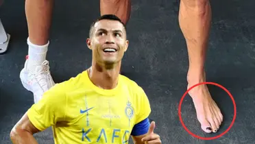 La verdad oculta en la foto de Cristiano Ronaldo y una particularidad en su pie