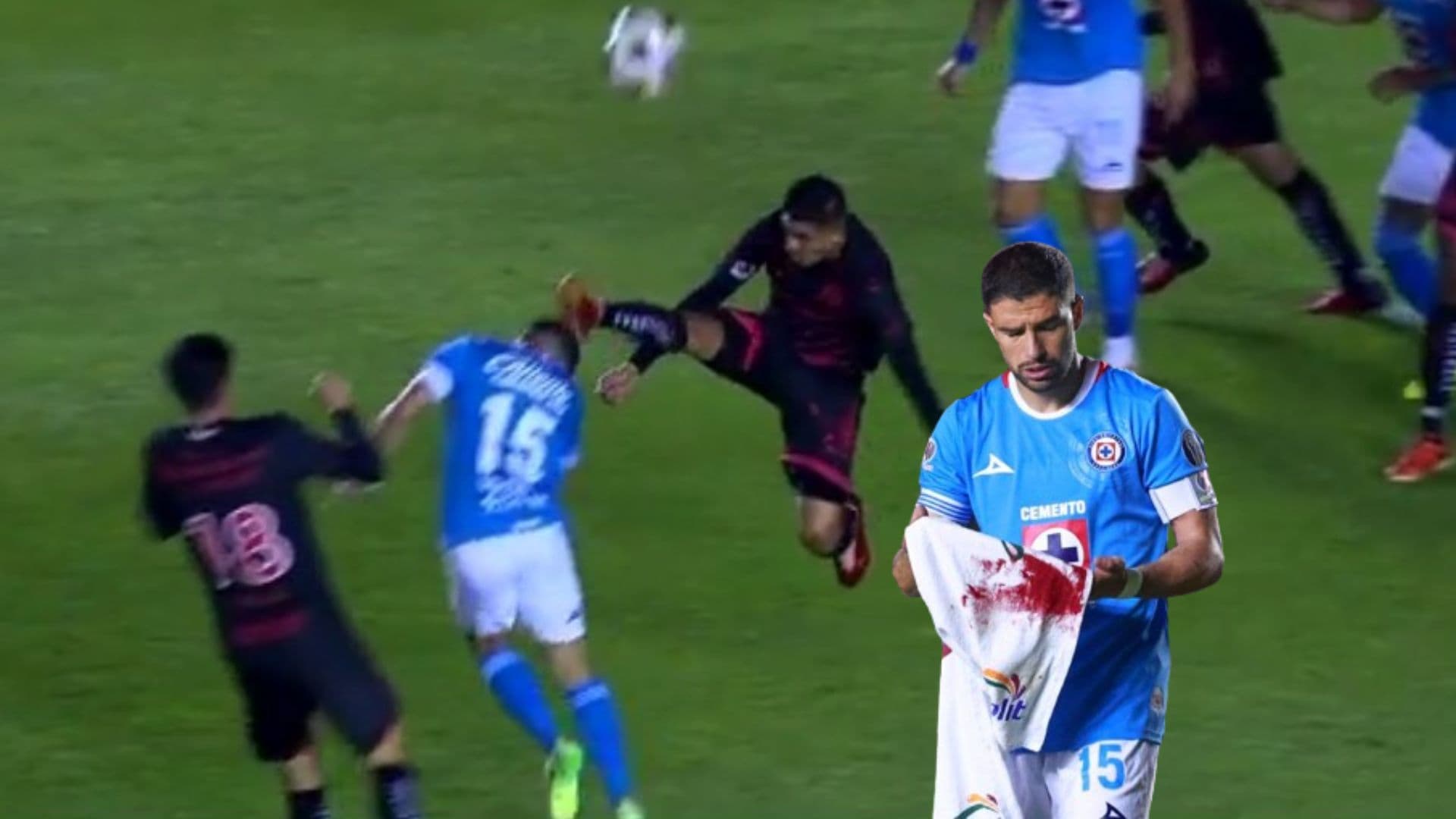 Nacho Rivero con sangre y la jugada que lo provocó