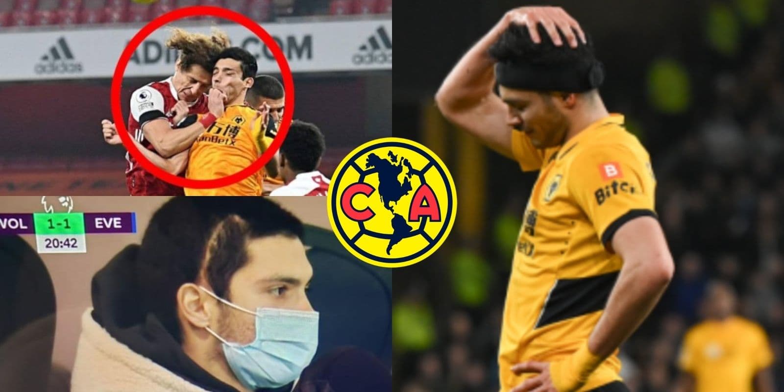 Raúl Jiménez confiesa no estar al 100% y aún tener una fisura en el cráneo.