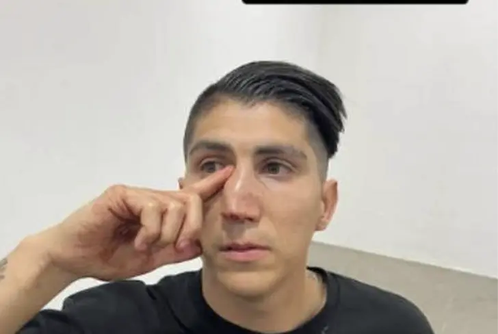 El hermano de Zaldívar tras las agresiones / FOTO INSTAGRAM