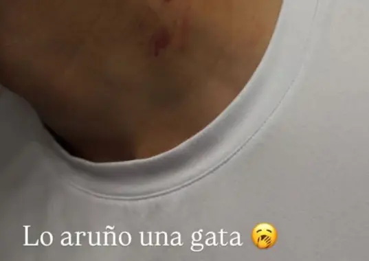 La historia de IG de la esposa de Richard Ledezma / FOTO INSTAGRAM